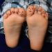 grzybica stóp i paznokci u dziecka